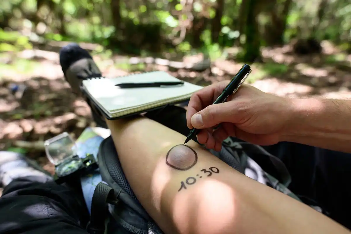 marking swelling line and writing time outdoors